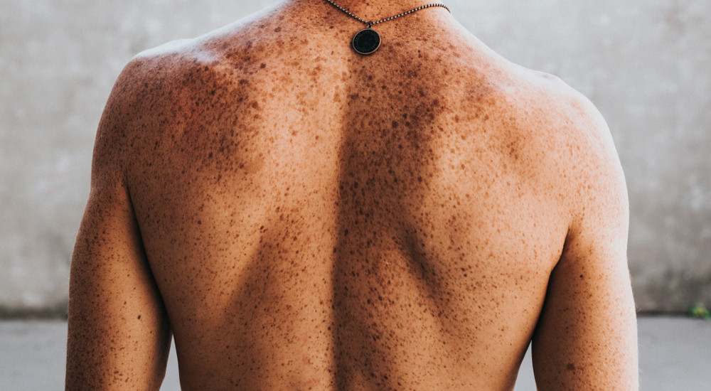 oncologia-dermatologica